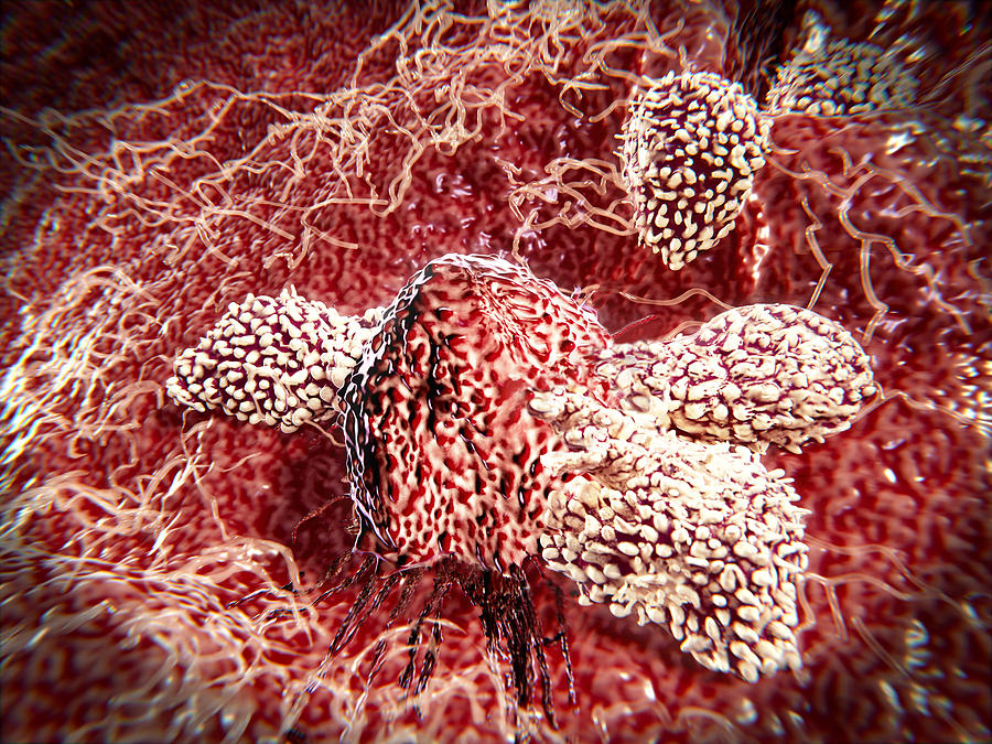 Cancer Cell Attacked By Lymphocytes Photograph by Juan Gaertner