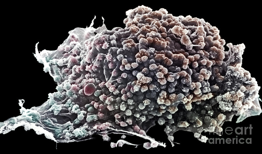 Cancer Cell Photograph by David M Phillips