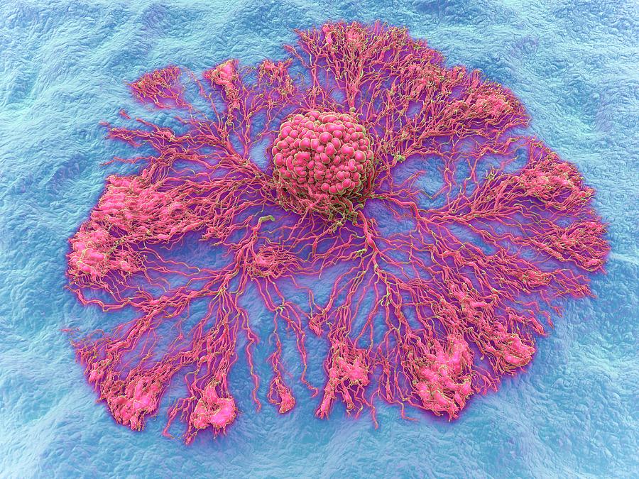Cancer Cell Spreading Photograph by Maurizio De Angelis