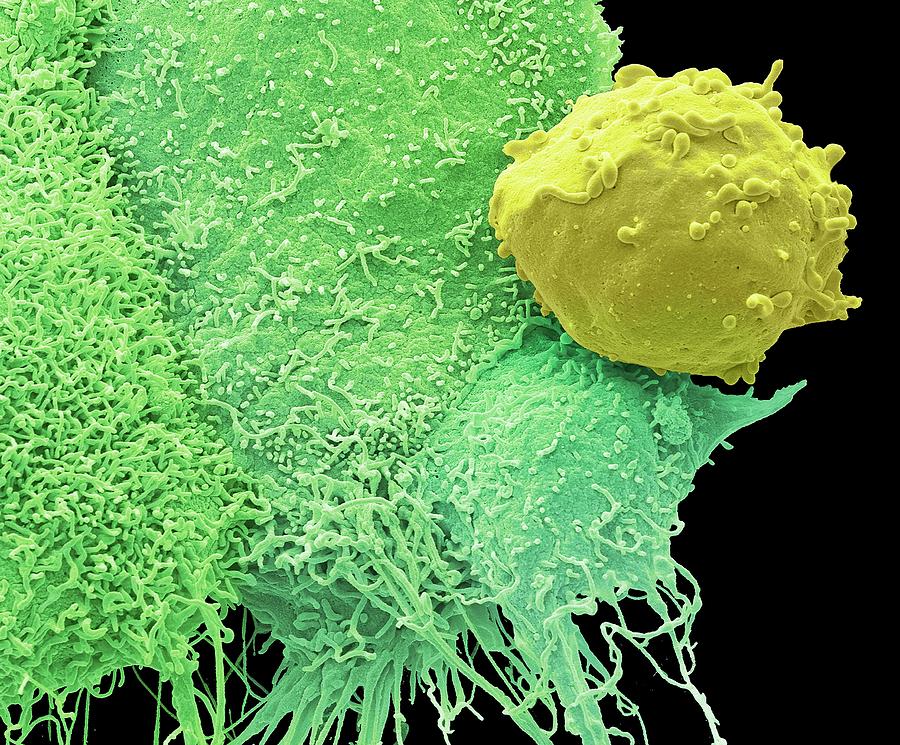 Cancer Cells And Monocyte Photograph by Steve Gschmeissner