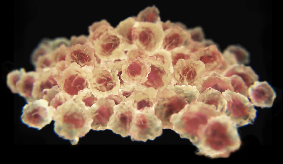 Cancer Cells Dividing Photograph by Anatomical Travelogue
