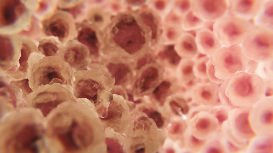 Cancer Cells Metastasizing Near Normal Photograph by Anatomical Travelogue