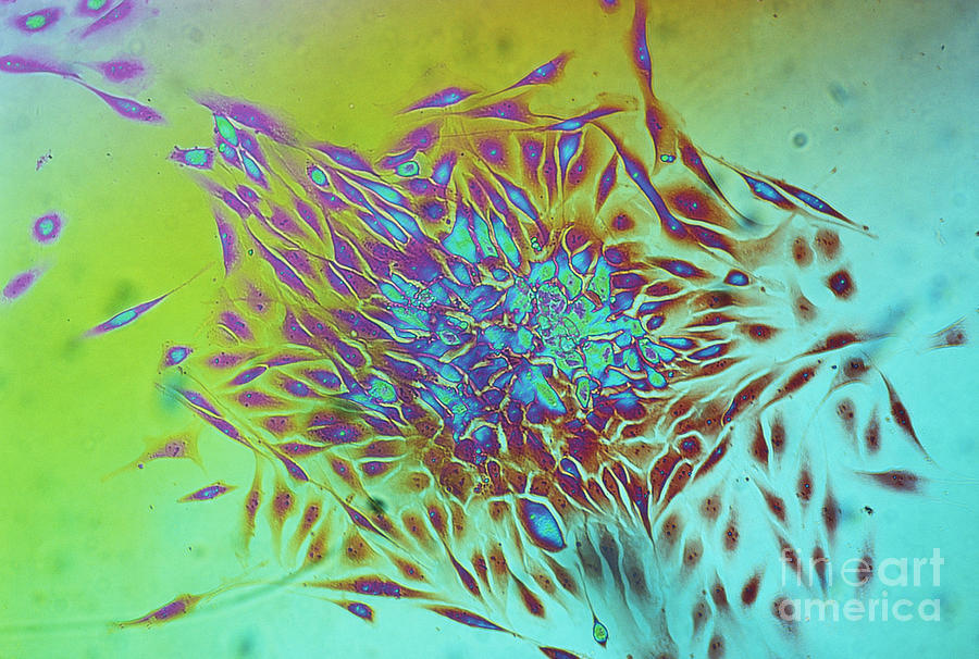 Cancer Cells Spreading Photograph by Dr Cecil H Fox