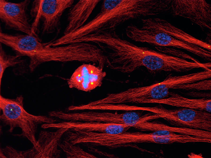 Cancerous Epithelial Cell Dividing Photograph by Carbone Cancer Center ...