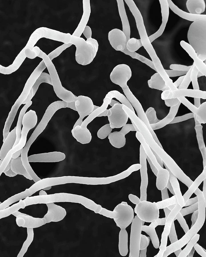 Candida Albicans Yeast And Hyphae Stages Photograph By Dennis Kunkel ...