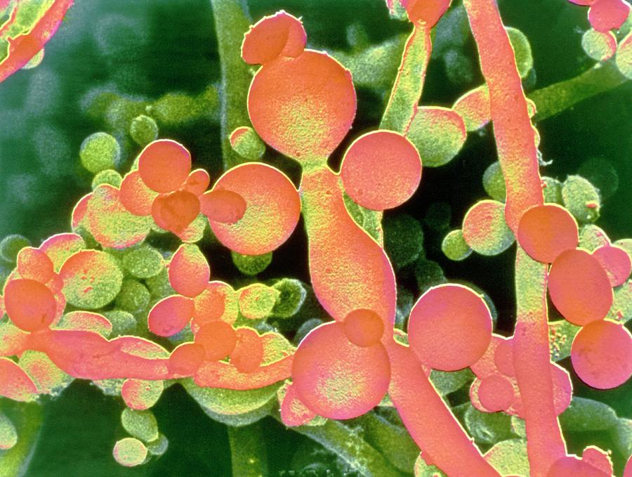 Candida Yeast Fungus Photograph by E. Gueho/science Photo Library