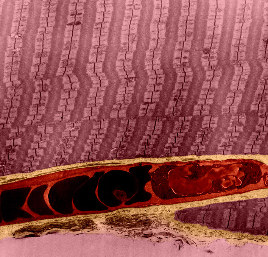 Capillary Between Muscle Fibers, Tem Photograph by Omikron