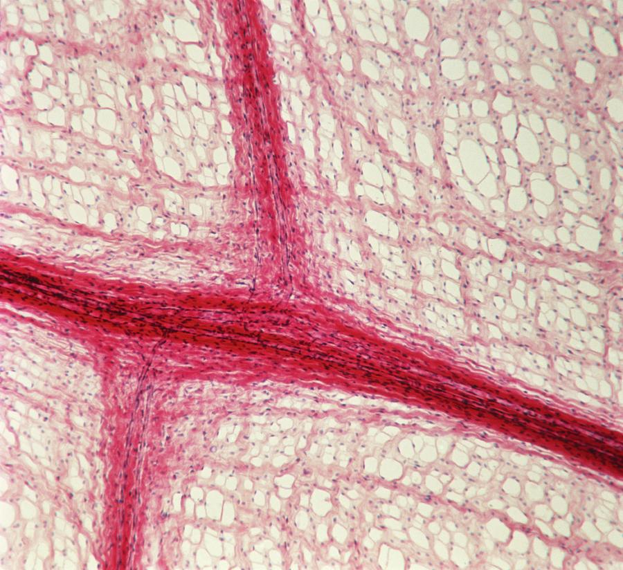 Capillary Network Photograph by Overseas/collection Cnri/science Photo ... Biology Diagrams