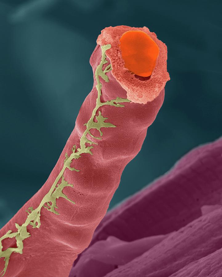 Capillary With Red Blood Cells Photograph by Dennis Kunkel Microscopy/science Photo Library