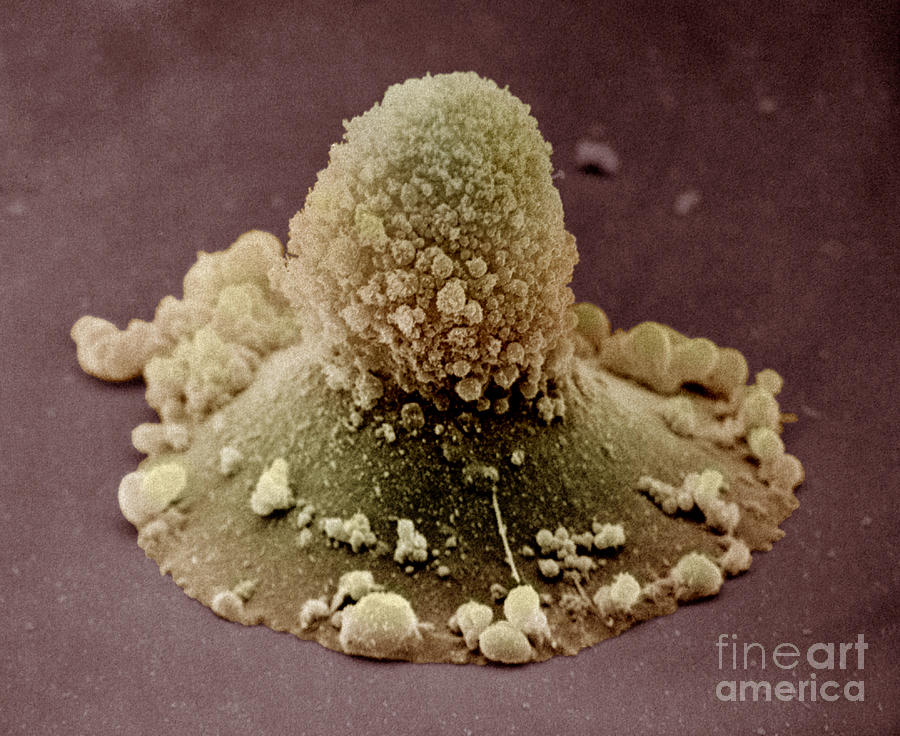 Carcinoma Cell Apoptosis Photograph by David M. Phillips