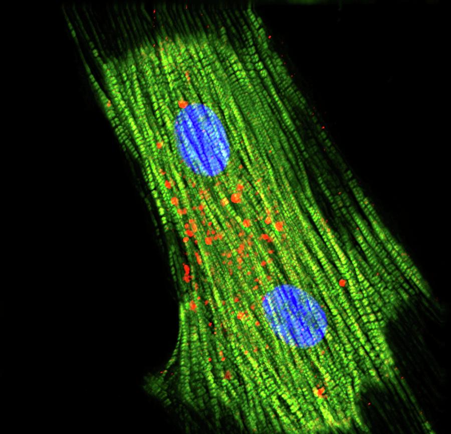 Cardiac Cell Differentiation Photograph by R. Bick, B. Poindexter, Ut Medical School/science Photo Library