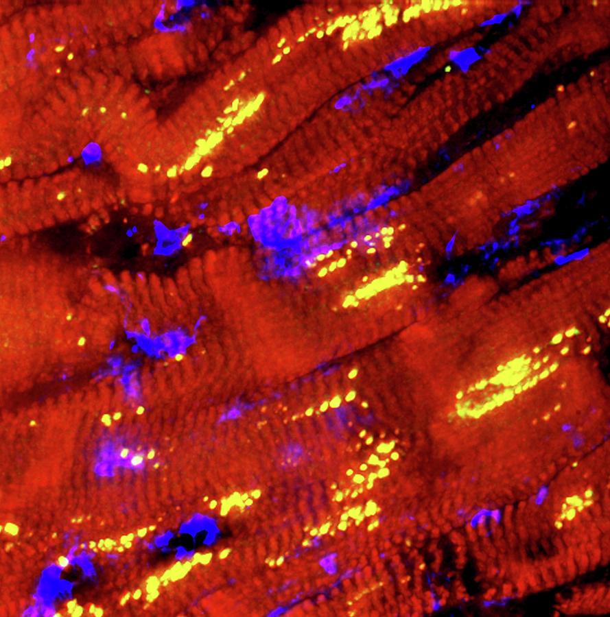 Cardiac Muscle Fibres Photograph by R. Bick, B. Poindexter, Ut Medical School/science Photo Library