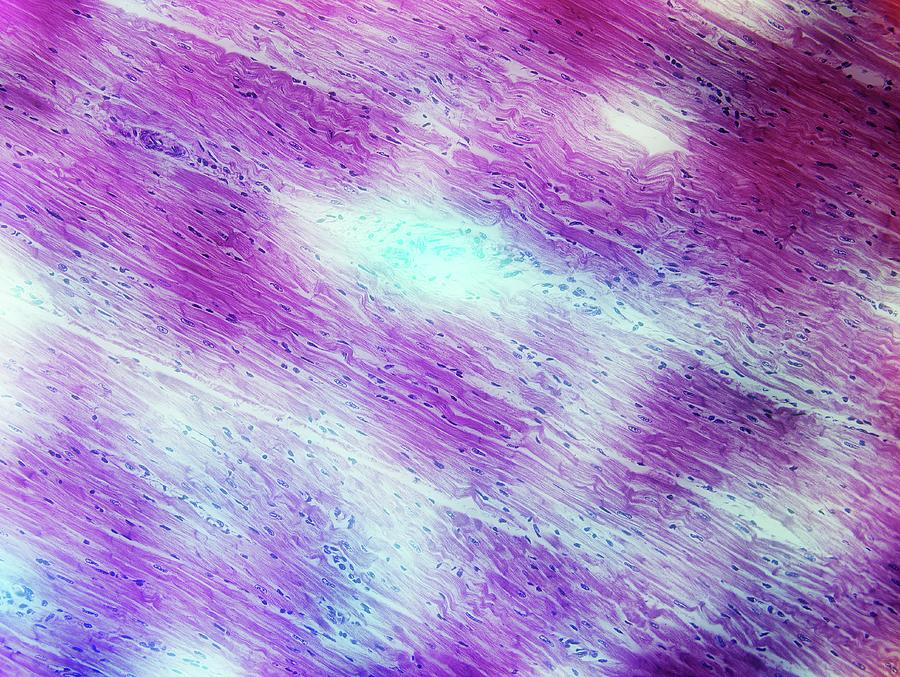 Cardiac Muscle Photograph by John Griffin, University Of Queensland/science Photo Library
