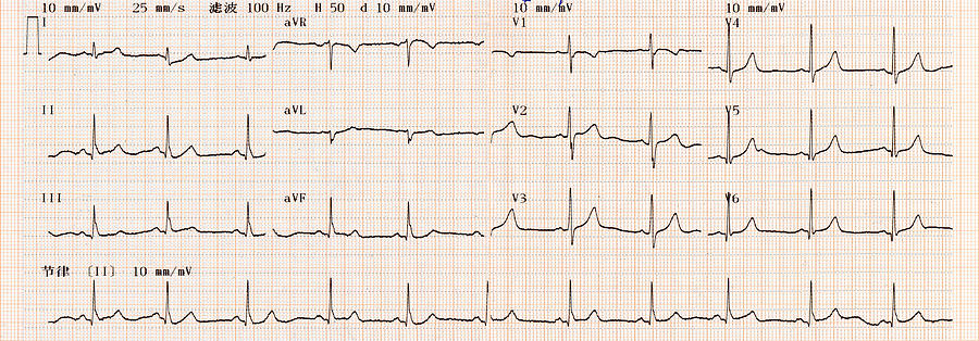 Cardiogram Chart (ECG) Photograph by Hudiemm