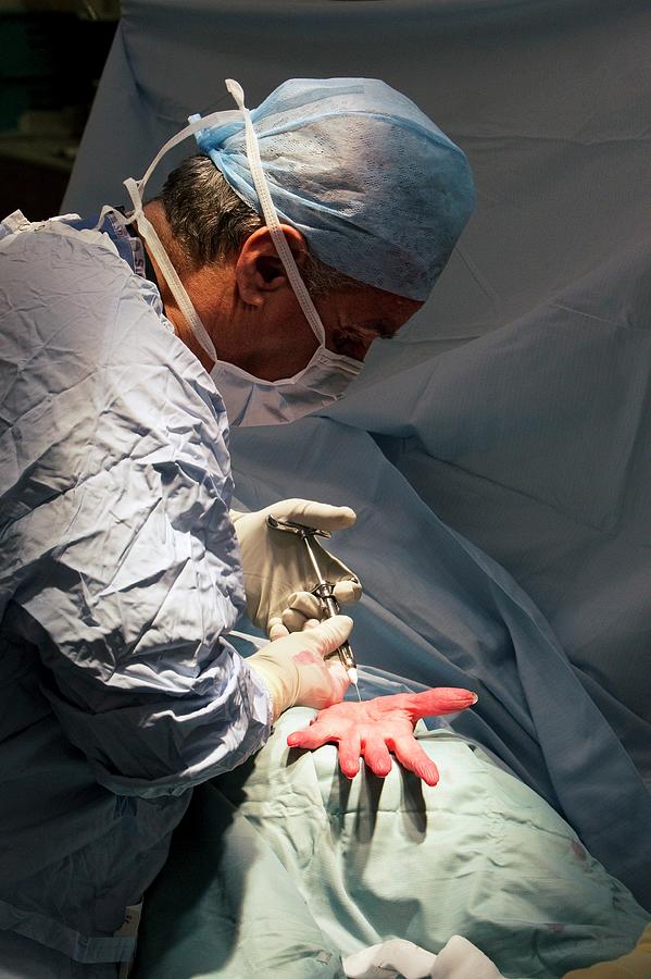 Carpal Tunnel Syndrome Surgery Photograph By Mark Thomas science Photo 