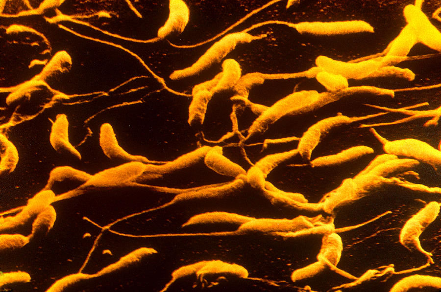 Caulobacter Photograph by Biology Pics