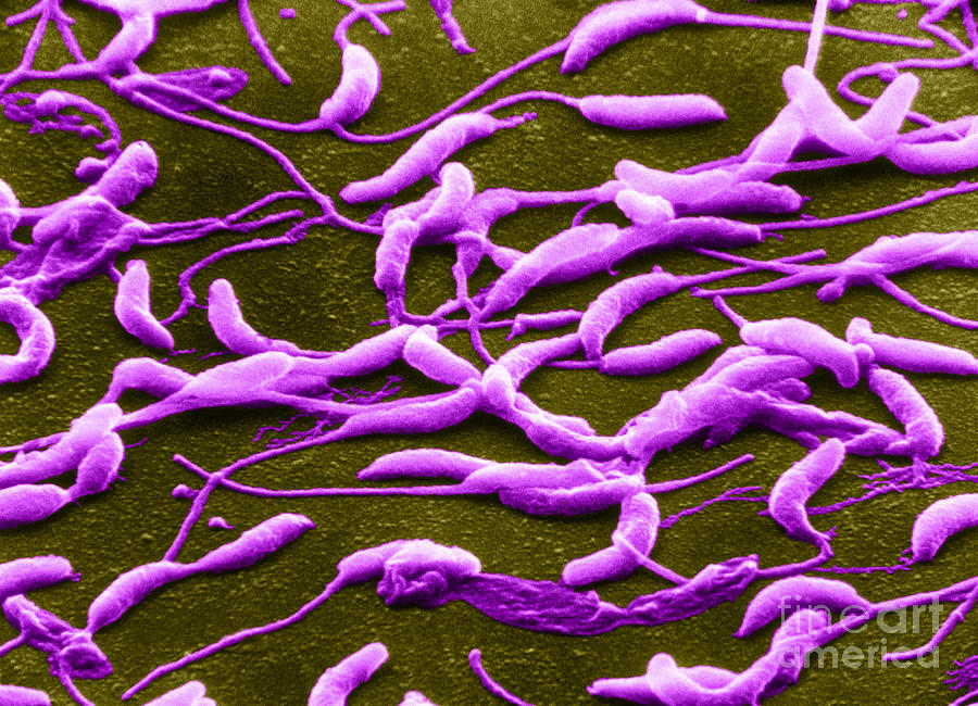 Caulobacter Crescentus, Sem Photograph by Biology Pics