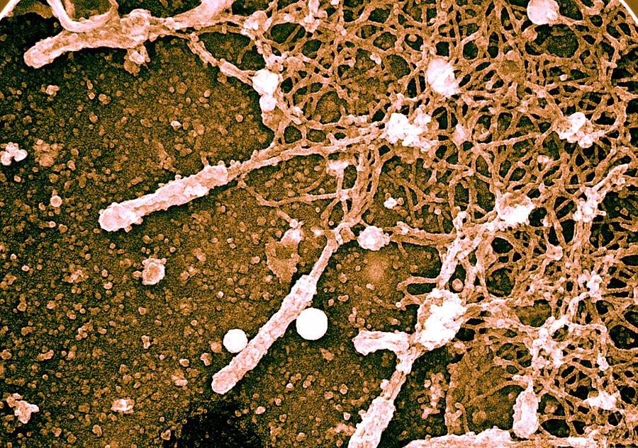 Cell Cytoskeleton Photograph by Ammrf, University Of Sydney