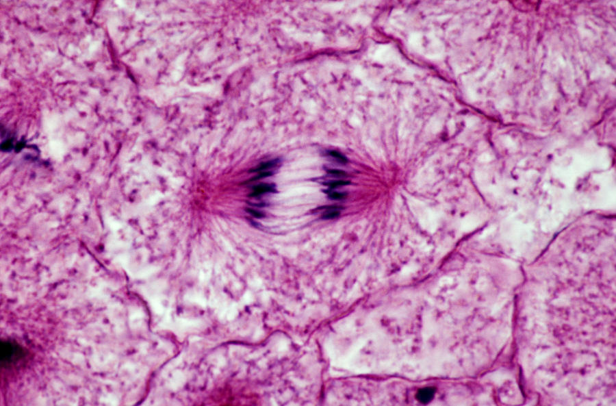 Cell In Late Anaphase Stage Of Mitosis Photograph by Michael Abbey ...