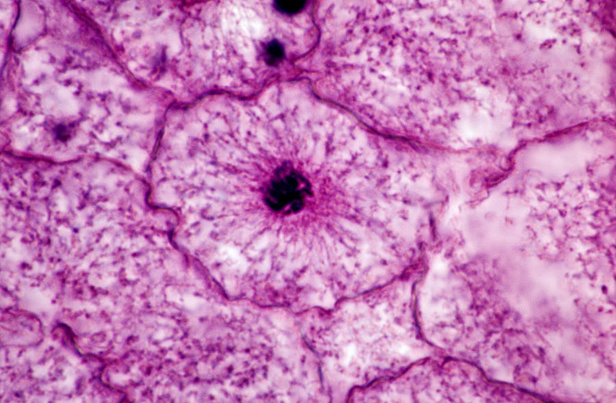 Cell In Late Prophase Stage Of Mitosis Photograph by Michael Abbey - Pixels