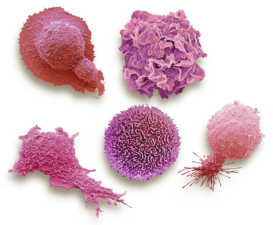 Cells From Cancers With Highest Mortality Rates Photograph By Steve Gschmeissner Science Photo