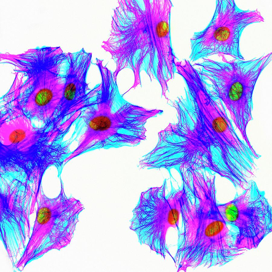 Cells Stained For Proteins Photograph by Kevin Mackenzie / University Of Aberdeen / Science Photo Library