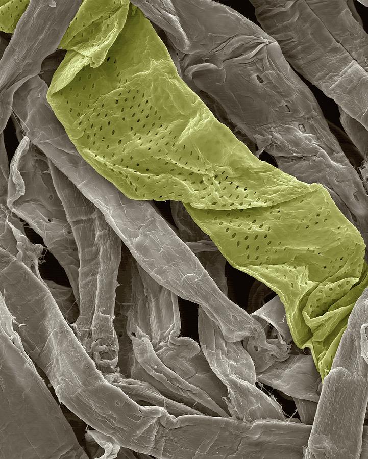 Cellulose Fibres In Toilet Paper Photograph by Dennis Kunkel Microscopy/science Photo Library