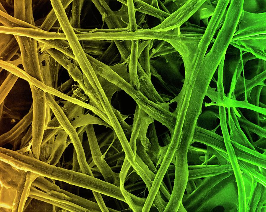 Cellulose Fibres (print Paper) Photograph by Dennis Kunkel Microscopy/science Photo Library