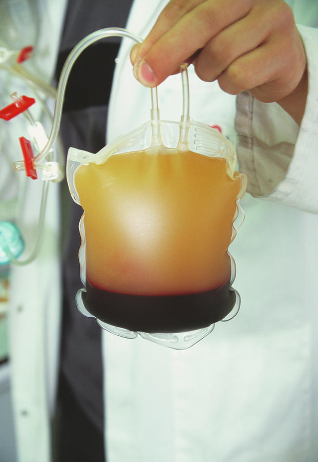 Centrifuged Donor Blood Photograph by Antonia Reeve/science Photo Library