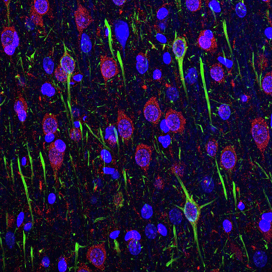 Cerbral Cortex Tissue Photograph by C.j.guerin, Phd, Mrc Toxicology Unit/ Science Photo Library