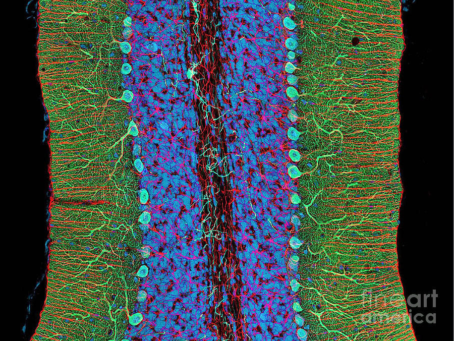 Cerebellum, Fluorescent Lm Photograph by Science Source