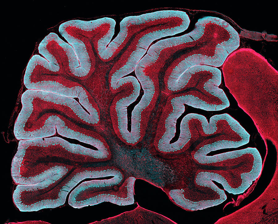 Cerebellum From A Brain Photograph by Thomas Deerinck, Ncmir