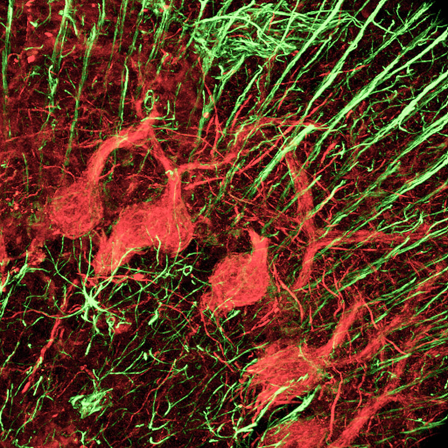 Cerebellum Tissue Photograph by C.j.guerin, Phd, Mrc Toxicology Unit/ Science Photo Library