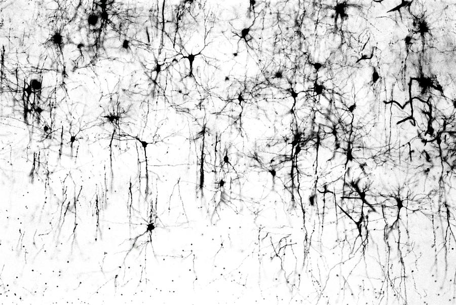 Cerebral Cortex Nerve Cells Photograph by Secchi-lecaque/roussel-uclaf/cnri/science Photo Library