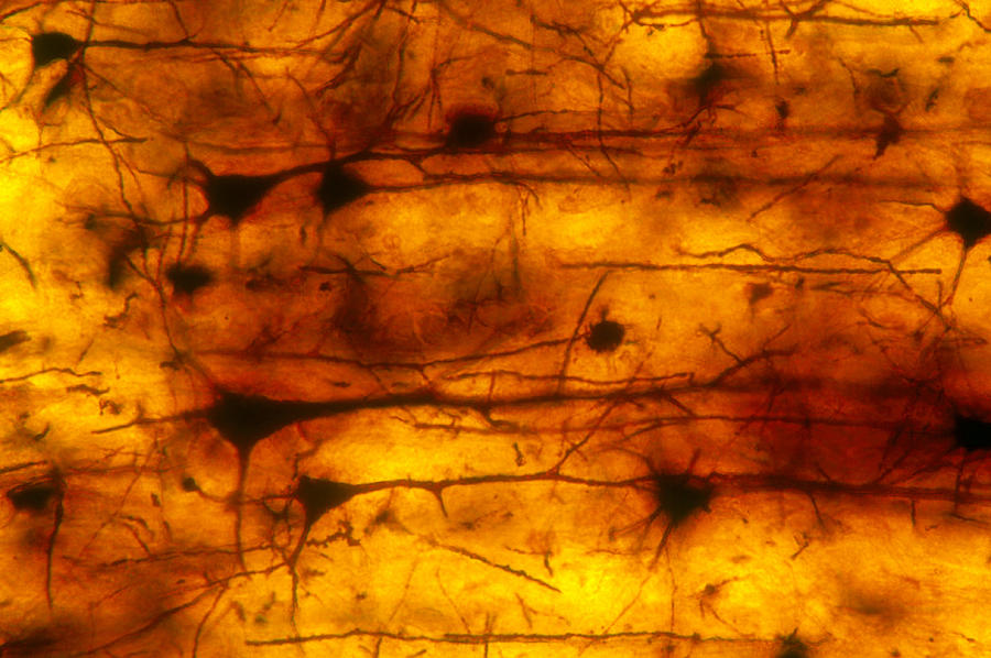 Brain Photograph - Cerebral Cortex Pyramidal Cells, Lm by Michael Abbey