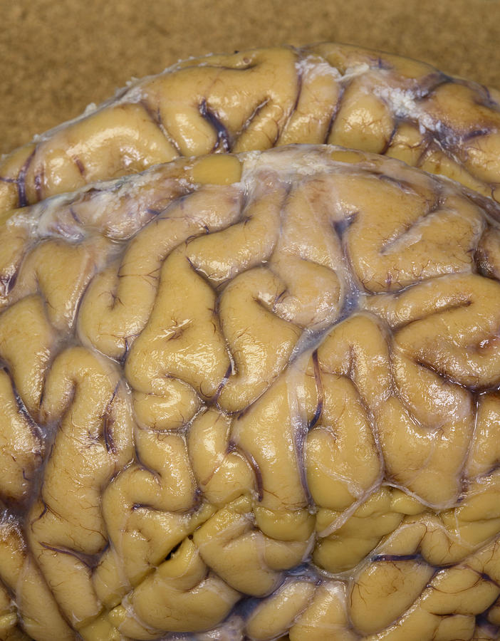 Cerebrum Of Human Brain, Gross Specimen Photograph by Science Stock Photography