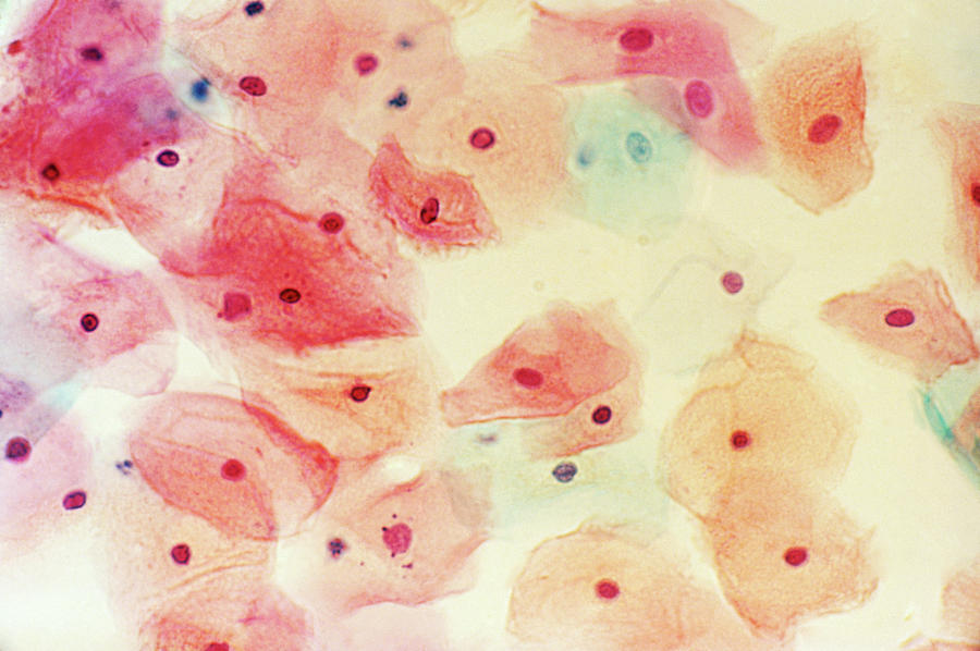 Cervical Smear Mid-cycle Photograph by Science Photo Library.