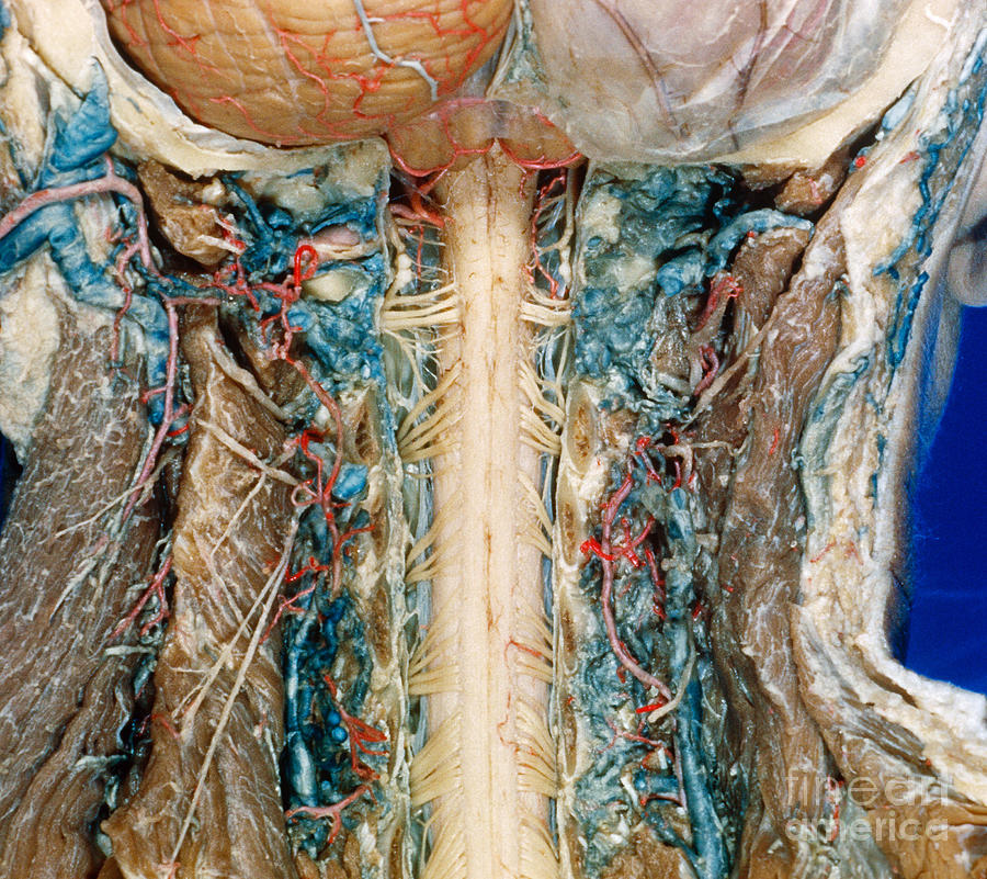 Cervical Spinal Cord, Posterior View Photograph by VideoSurgery