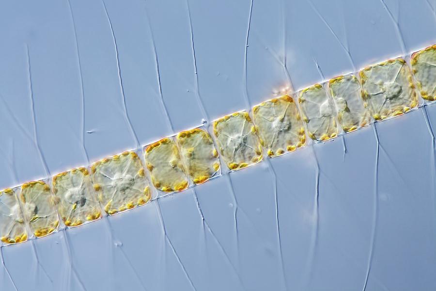 Chaetoceros Diatom Photograph by Gerd Guenther