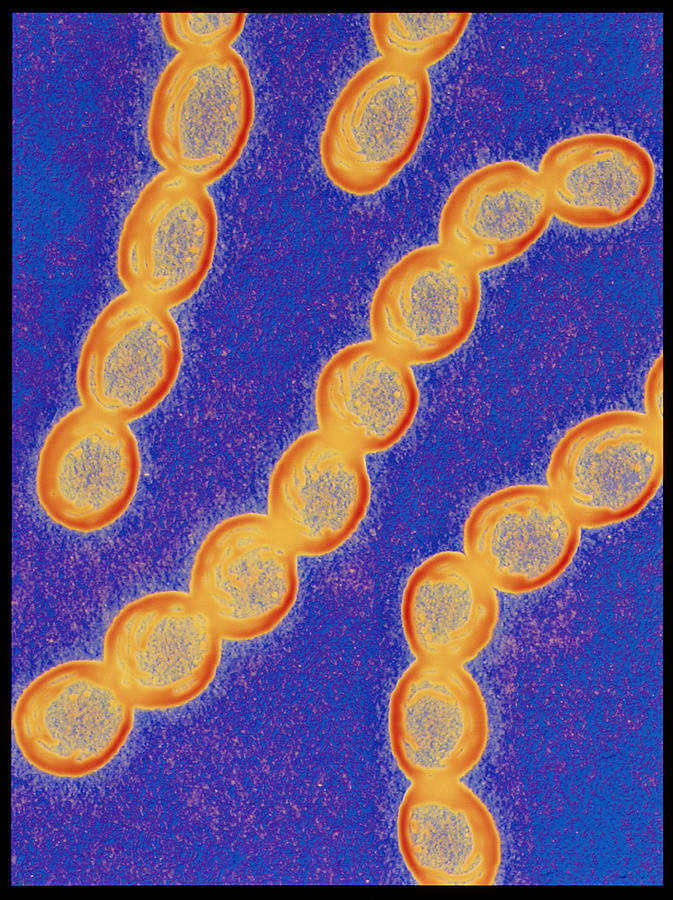 Chains Of Streptococcus Pyogenes Bacteria Photograph by Alfred Pasieka/science Photo Library