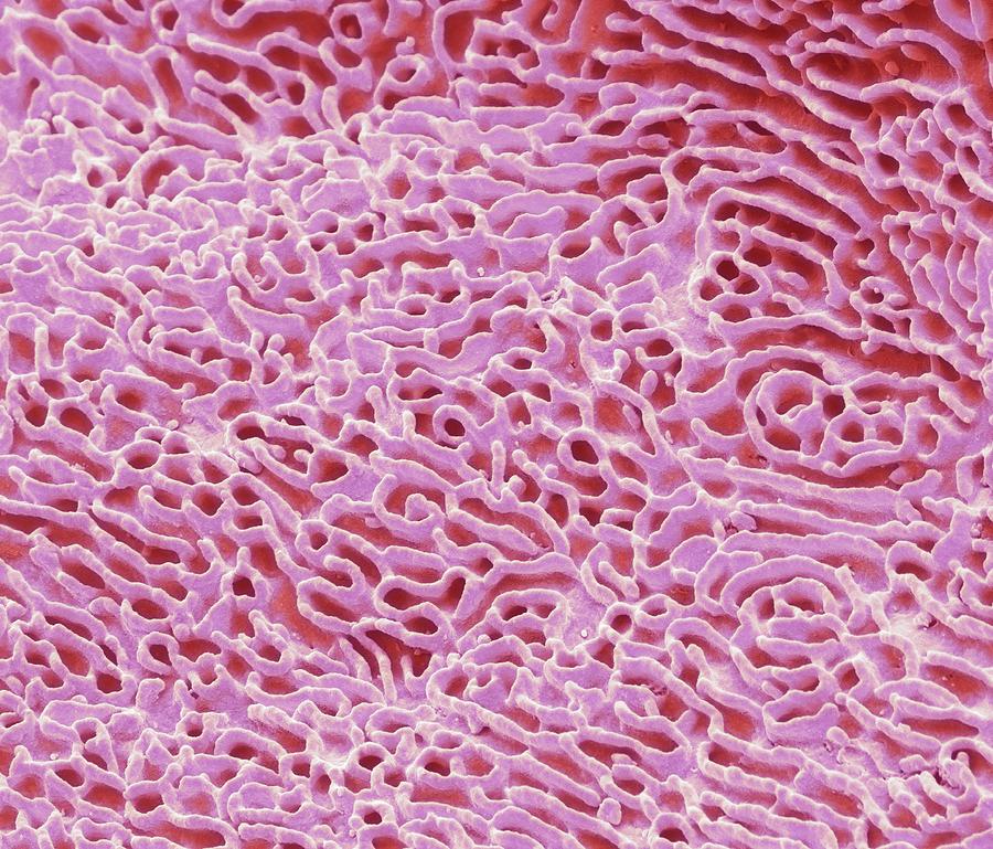 Biology Photograph - Cheek Squamous Cell Detail by Steve Gschmeissner