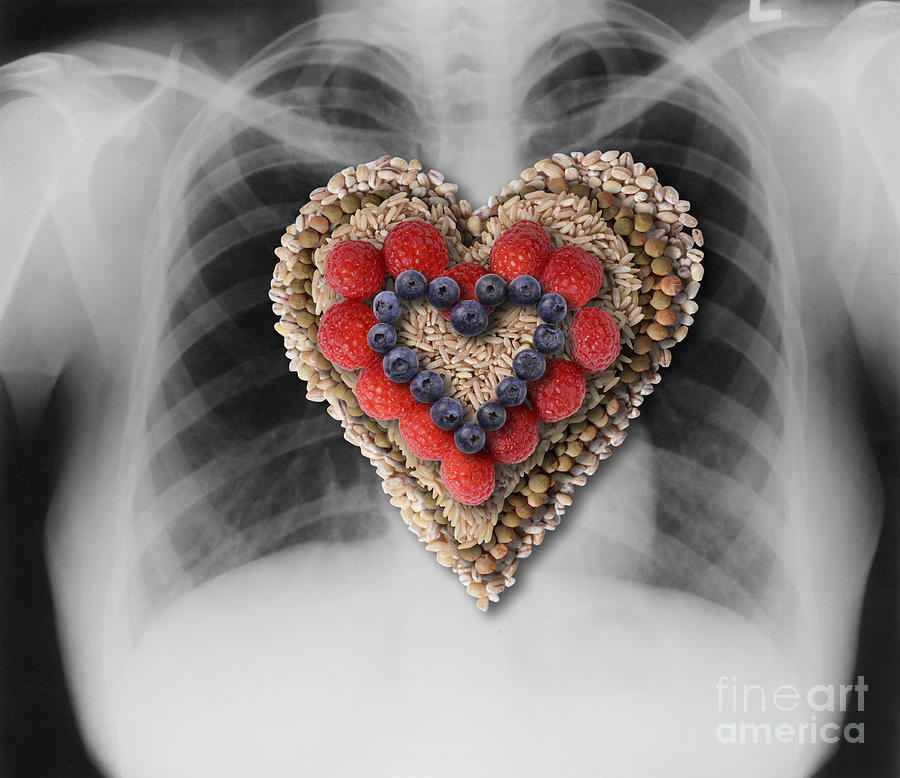 Chest X-ray & Heart-healthy Foods Photograph by Gwen Shockey