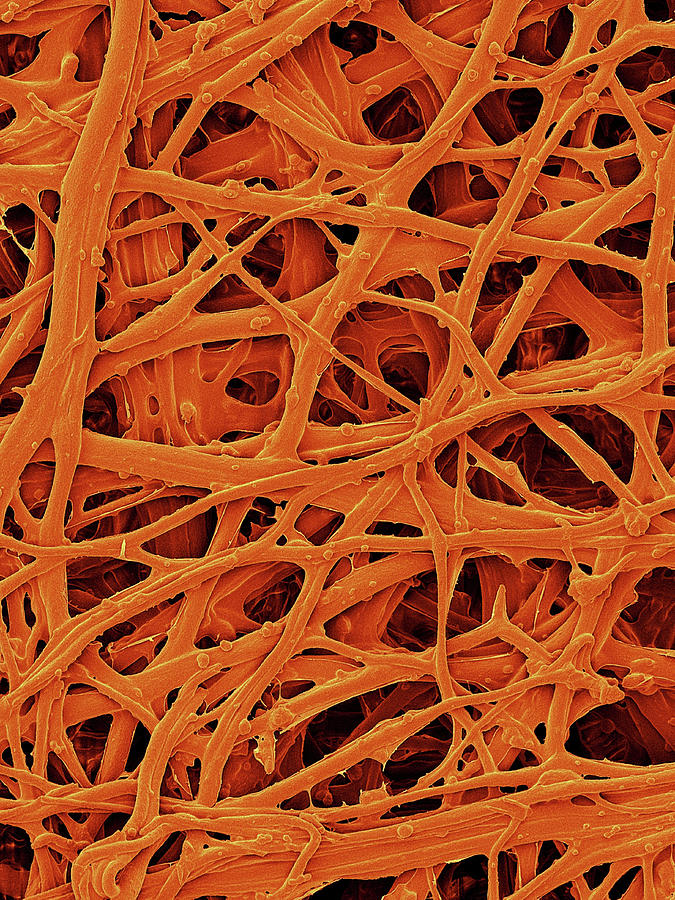 Chicken Eggshell Inner Membrane Photograph by Dennis Kunkel Microscopy/science Photo Library
