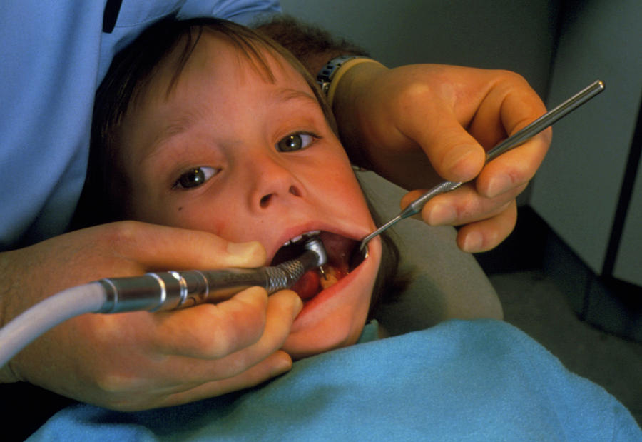 Child At Dentists Having Tooth Drilled Photograph by Hattie Young/science Photo Library