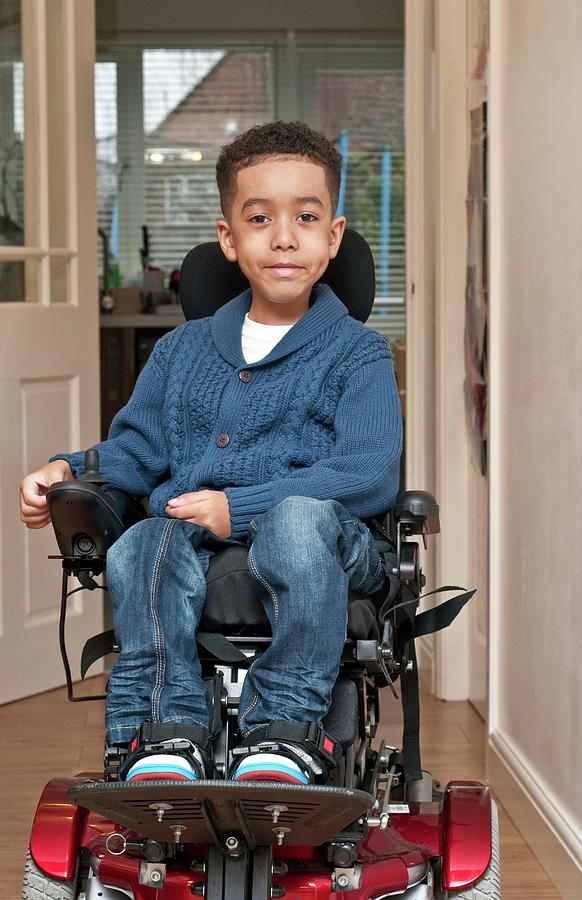 Child With Muscular Dystrophy Photograph by Cecilia Magill/science Photo Library