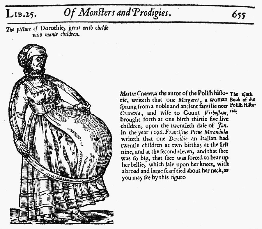 16th Century Painting - Childbirth Anomalies by Granger