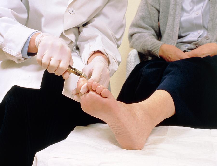 Chiropodist Cuts The Toenails Of Elderly Patient Photograph by Chris ...