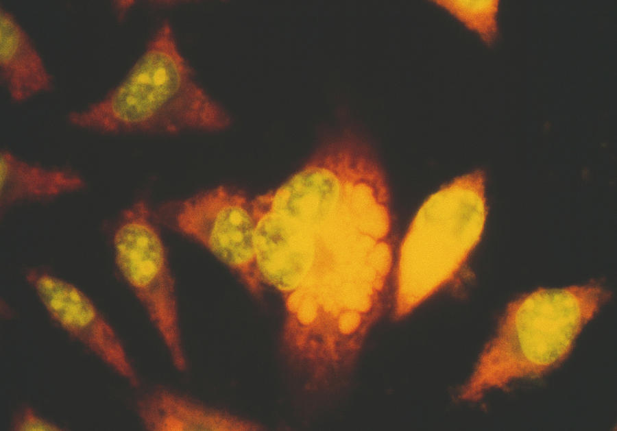 Chlamydia Bacteria Cell Culture Photograph by Cnri/science Photo