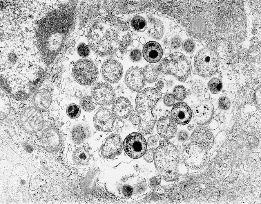 Хламидии 4. Хламидия трахоматис микроскопия. Хламидия трахоматис под микроскопом.