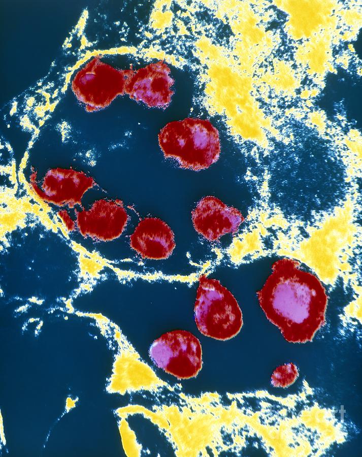 Coronary Artery Photograph - Chlamydia Bacteria In Coronary Artery by C.c. Kuo, University Of Washington, Seattle